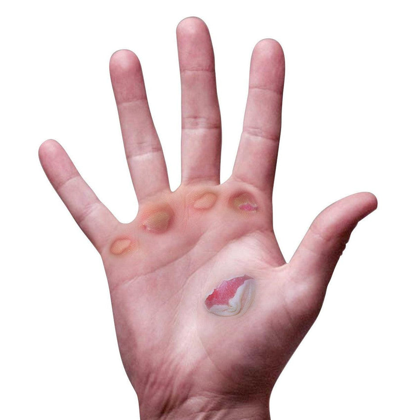 Palm Protectors - Lightweight Blister Protection Gloves
